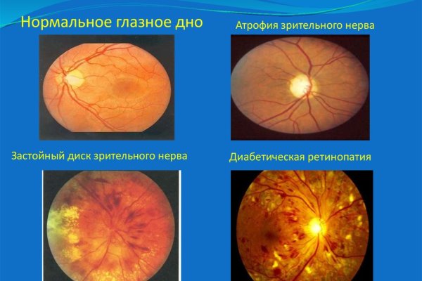 Кракен запрещенные вещества